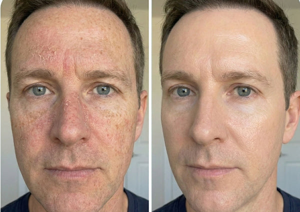 Paul R., 35